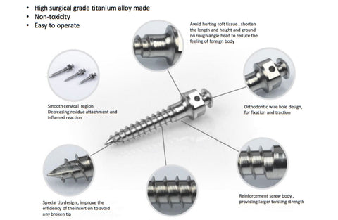 TADs - Surgical Grade Titanium Alloy Microscrews $21.00/TAD